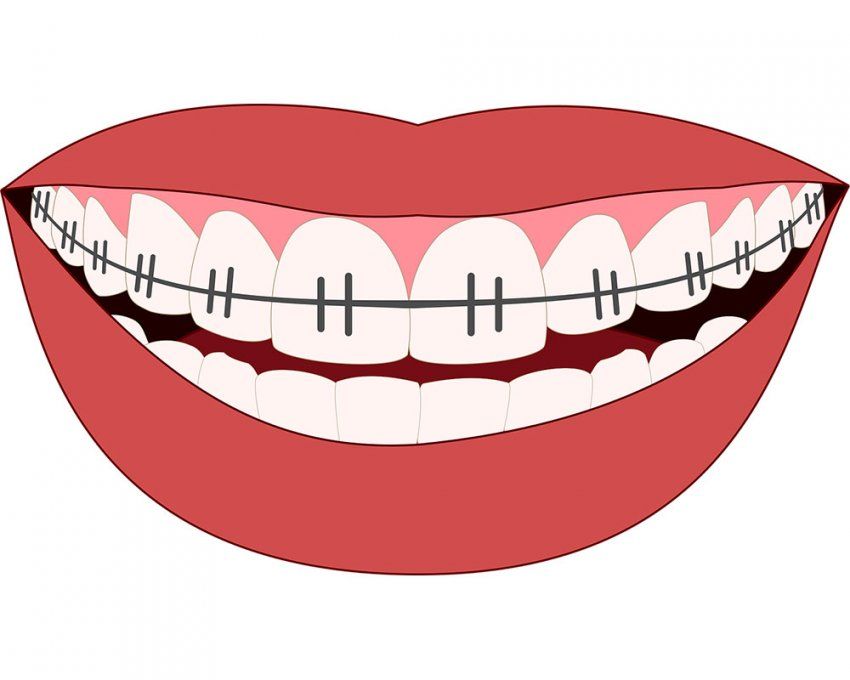 Ortopedia dentofacial en Segovia