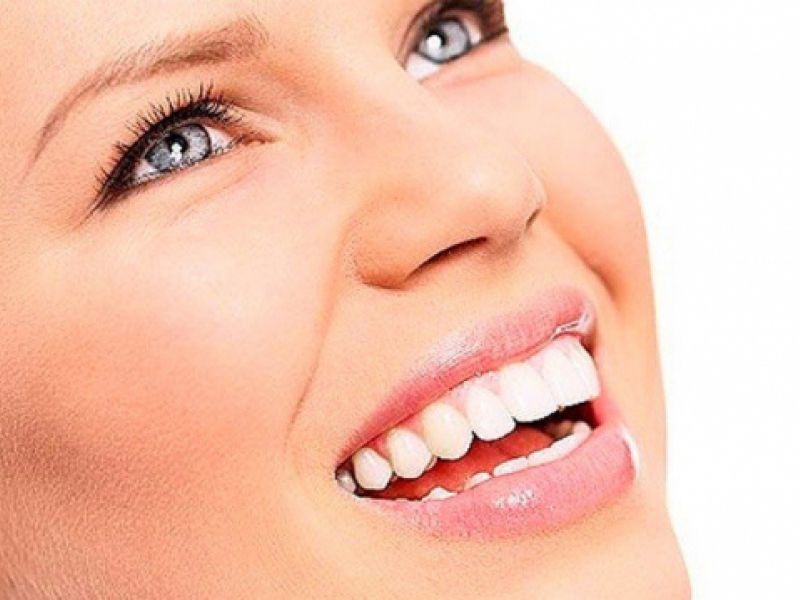 estetica dental en segovia